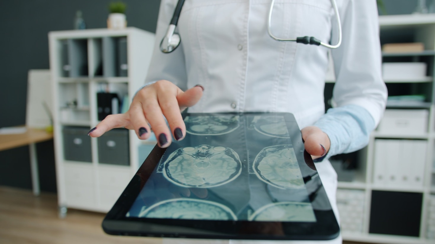Enfermagem e Distrofia Muscular de Duchenne: Guia Prático